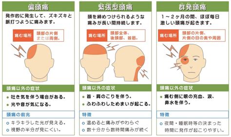 頭痛 解決|頭痛の治し方は？種類・原因・治療薬について解説